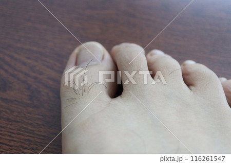 男性の足の指の毛 男性の足の指の毛 116261547