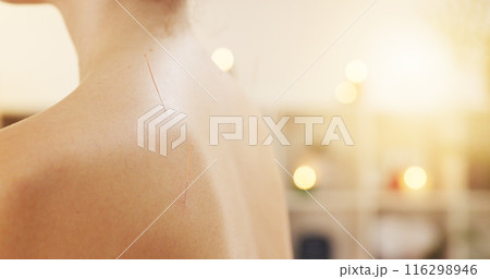 Back, massage and person with needles for acupuncture closeup for health, wellness and relax at spa. Skin, treatment and alternative medicine with pin for traditional therapy or healing pain in salon Back, massage and person with needles for acupuncture closeup for health, wellness and relax at spa. Skin, treatment and alternative medicine with pin for traditional therapy or healing pain in salon 116298946