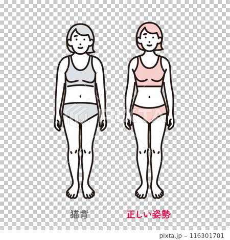 Simple illustration: A woman with good posture and a woman with a hunched back 116301701