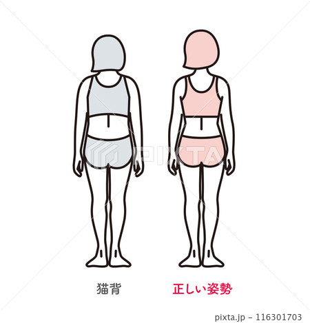 シンプル　イラスト　正しい姿勢の女性と猫背の女性の後ろ姿 116301703