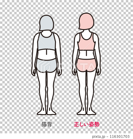 シンプル　イラスト　正しい姿勢の女性と猫背の女性の後ろ姿 116301703