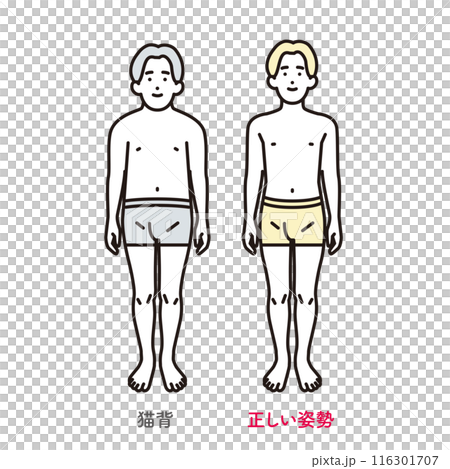 Simple illustration: A man with good posture and a man with a hunched back 116301707