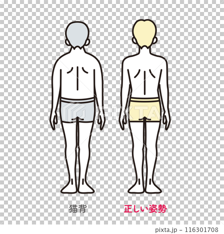 シンプル　イラスト　正しい姿勢の男性と猫背の男性 116301708