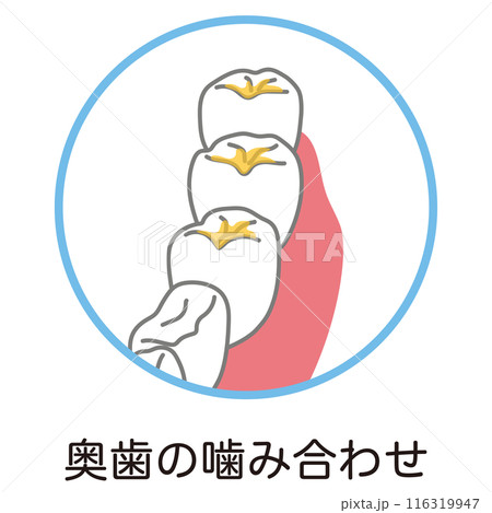 奥歯の噛み合わせに溜まった歯垢　歯磨き　磨き残し 116319947