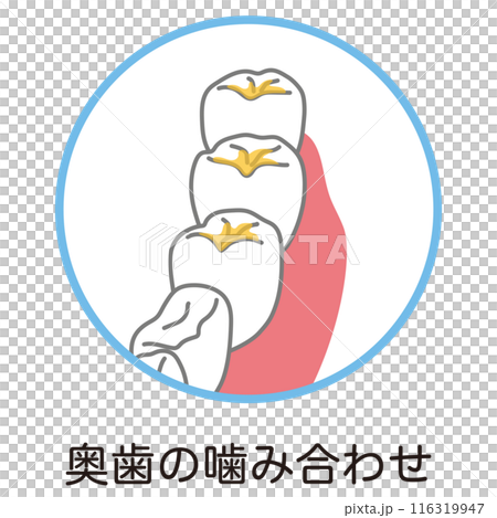 奥歯の噛み合わせに溜まった歯垢　歯磨き　磨き残し 116319947