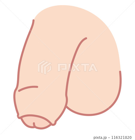 仮性包茎の男性生殖器　医療 116321820