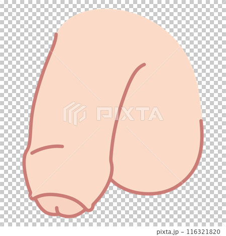 仮性包茎の男性生殖器　医療 116321820