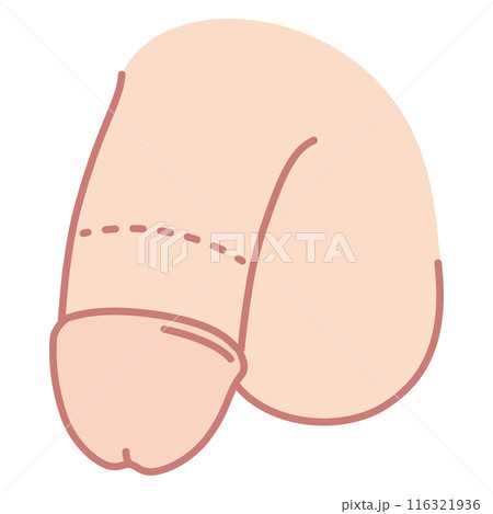 男性生殖器 医療 男性生殖器 医療 116321936