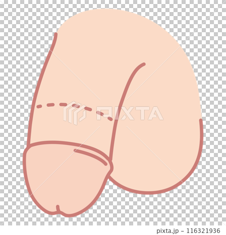 男性生殖器 医療 男性生殖器 医療 116321936