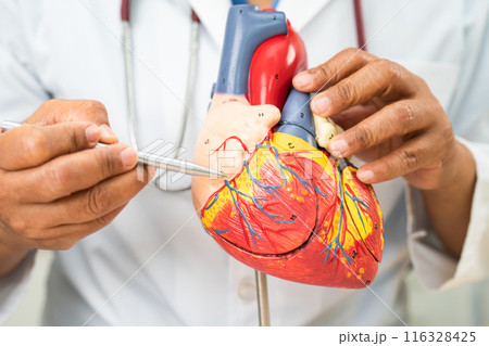 Cardiovascular disease CVD, Asian doctor holding human anatomy model for learn and treat heart disease. Cardiovascular disease CVD, Asian doctor holding human anatomy model for learn and treat heart disease. 116328425