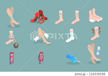 3D Isometric Flat Vector Set of Varicose Treatment, Health Care 3D Isometric Flat Vector Set of Varicose Treatment, Health Care 116339298