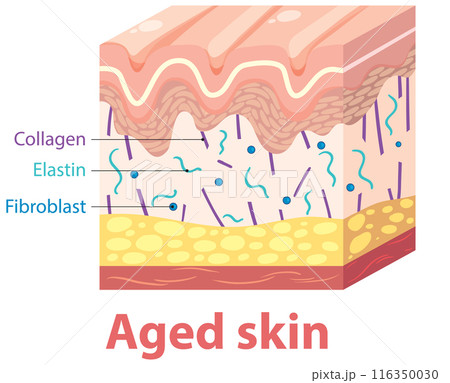 Aged Skin Cross-Section Diagram Aged Skin Cross-Section Diagram 116350030