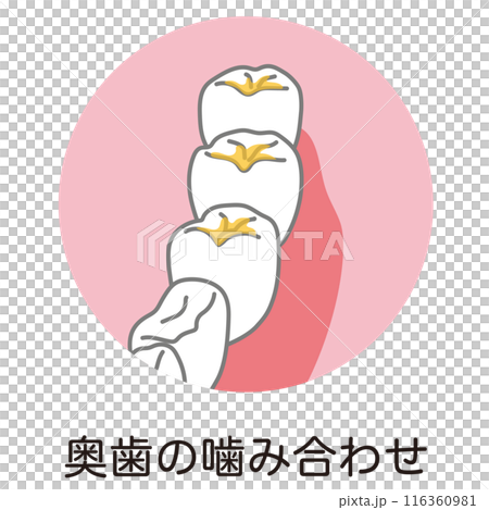 Plaque accumulated on the bite of the back teeth, brushing, and areas left unbrushed 116360981