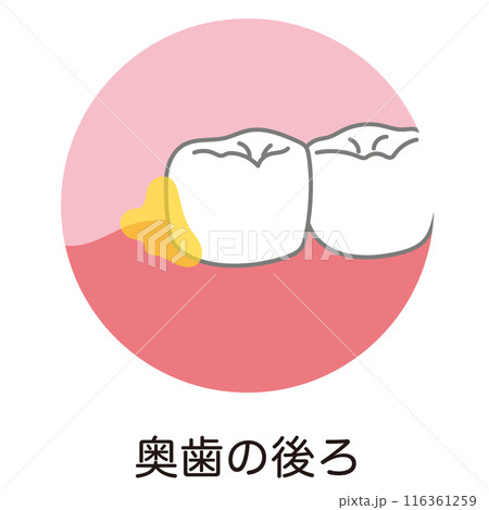奥歯の後ろに溜まった歯垢 歯磨き 磨き残し 奥歯の後ろに溜まった歯垢 歯磨き 磨き残し 116361259