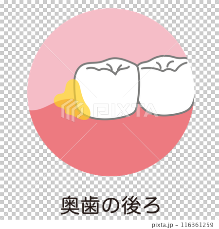 後牙、刷牙、剩菜後堆積的牙菌斑 116361259