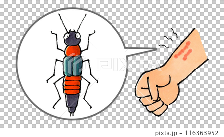 やけど虫の体液で炎症した腕 やけど虫の体液で炎症した腕 116363952