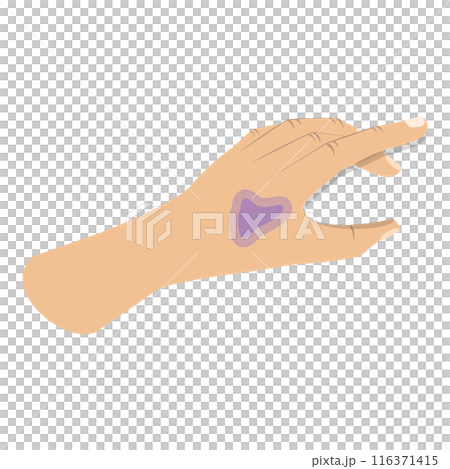 3D Isometric Flat  Illustration of First Aid For Trauma. Item 6 116371415