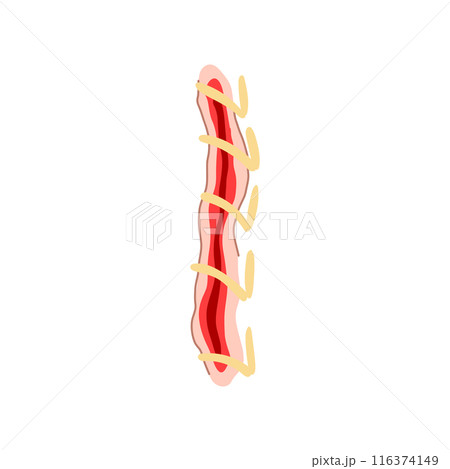 doctor suture cartoon vector illustration 116374149