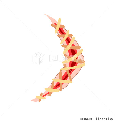 stitch suture cartoon vector illustration 116374150