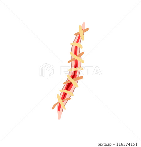 needle suture cartoon vector illustration 116374151