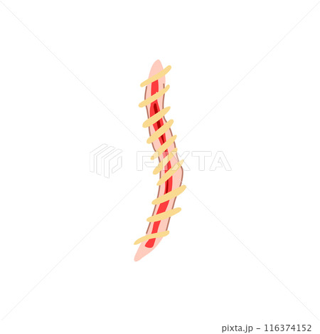 surgical suture cartoon vector illustration 116374152