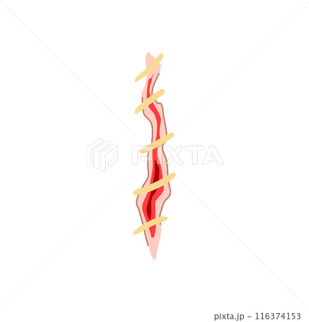 surgery suture cartoon vector illustration 116374153