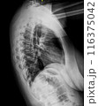 X-ray of thoracic spine. Lateral view. Vertebrae and intervertebral joints of chest. Healthy backbone anatomy radiography image 116375042