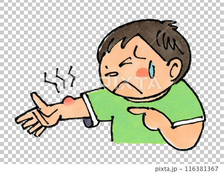 A boy bitten by an insect A boy bitten by an insect 116381367