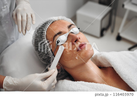 A woman applies gel to her face before a laser procedure. 116403970