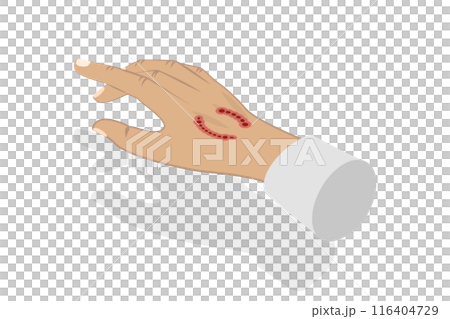 3D Isometric Flat  Illustration of Dog Bite, Rabies Virus 116404729