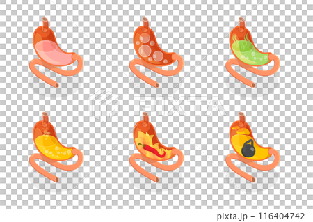 3D Isometric Flat  Set of Stomach Problems, Digestive System Issues 116404742