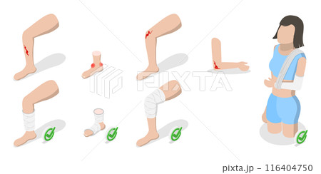 3D Isometric Flat  Illustration of How To Heal Injuries, Methods of Bandaging 116404750