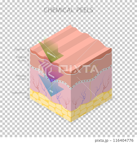 3D Isometric Flat Illustration of Skin Chemical Peel, Beauty Aesthetic Treatment 3D Isometric Flat Illustration of Skin Chemical Peel, Beauty Aesthetic Treatment 116404776
