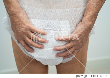 Asian elderly woman wearing diaper for loss of bladder urinary incontinence control. Asian elderly woman wearing diaper for loss of bladder urinary incontinence control. 116416926