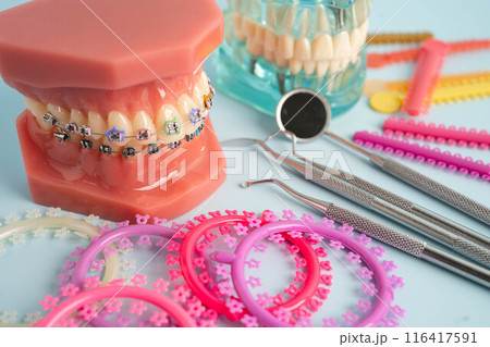 Orthodontic ligatures rings and ties, elastic rubber bands on orthodontic braces, model for dentist studying about dentistry. 116417591