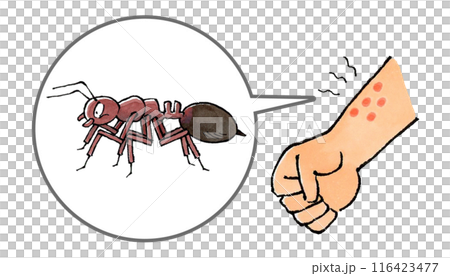 手臂被紅火蟻蟄了 手臂被紅火蟻蟄了 116423477