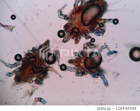 倉庫の中にいたダニの顕微鏡写真 116438594