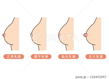 乳頭のかたち　乳首のタイプ　種類 116441955