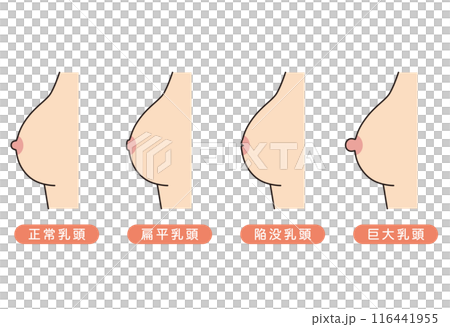 Nipple shape, nipple type, variety 116441955