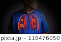 Lung cancer. 3d x-ray concept 116476050