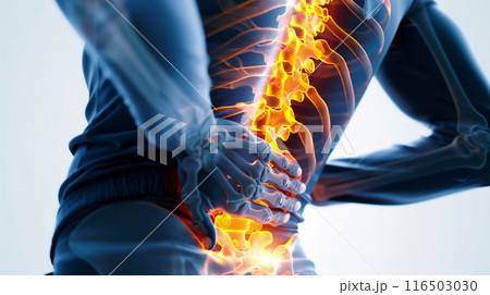 腰痛のイメージ	 腰痛のイメージ	 116503030