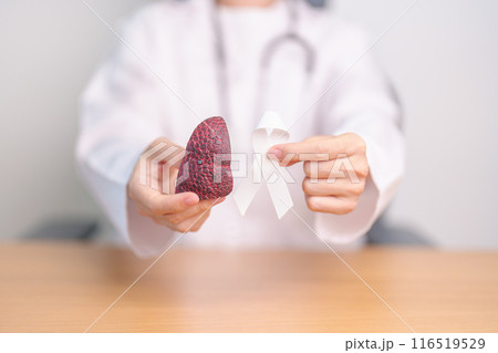 November Lung Cancer Awareness month. Doctor with Smoker Lung anatomy model and White ribbon in hospital. Healthcare and World Cancer day concept 116519529