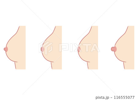 乳頭のかたち 乳首のタイプ 種類 乳頭のかたち 乳首のタイプ 種類 116555077