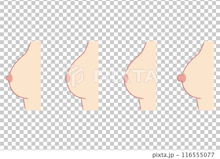 乳頭のかたち 乳首のタイプ 種類 乳頭のかたち 乳首のタイプ 種類 116555077