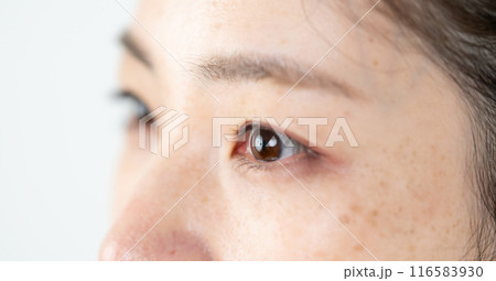 ミドル 女性 シミ ミドル 女性 シミ 116583930