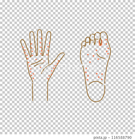 經常出現汗水泡的區域的圖像插圖集（手和腳底） 116588790