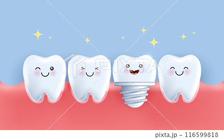 Dental implant vector Illustration. orthopedic treatment modern method. advertising of dental care products. horizontal concept on blue background 116599818