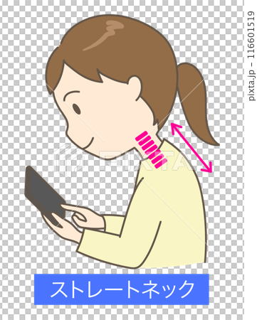 Young woman with straight neck looking at smartphone with hunched back 2 116601519