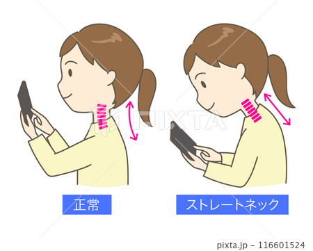 スマホを見ているストレートネックの若い女性の比較イラスト スマホを見ているストレートネックの若い女性の比較イラスト 116601524
