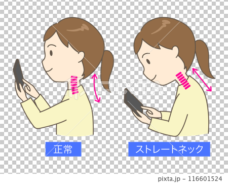 Comparison illustration of a young woman with a straight neck looking at a smartphone 116601524